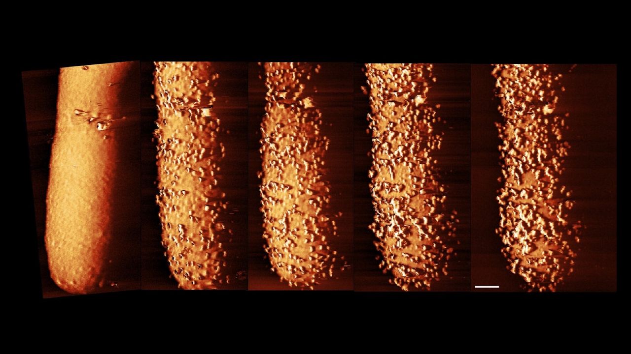 Striking images record an antibiotic slaying germs in genuine time