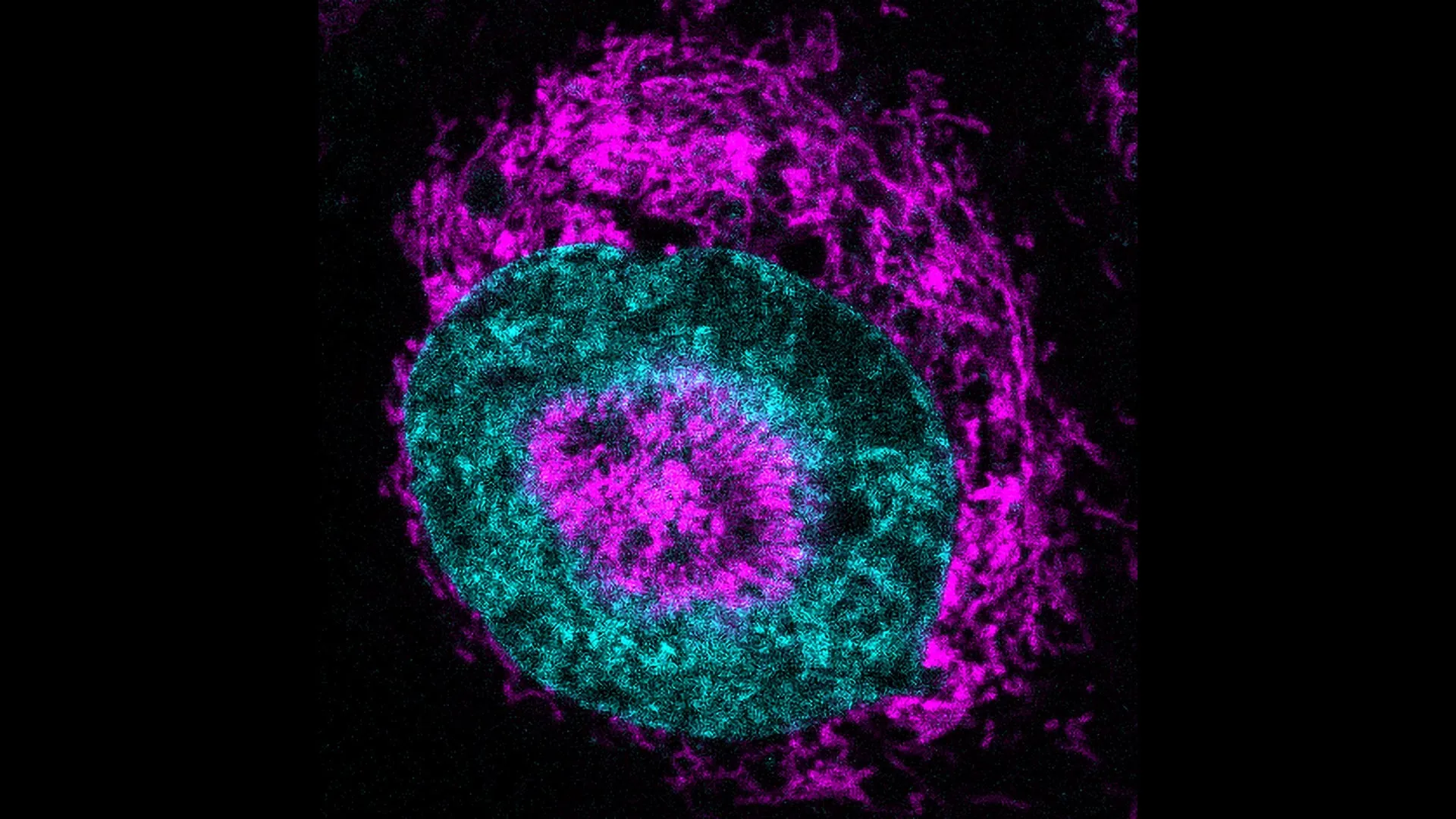 1843-researchers-simply-discovered-cancer-cells-concealed-source-of-power.webp